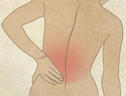 An illustration of a patient with a pain in her back.