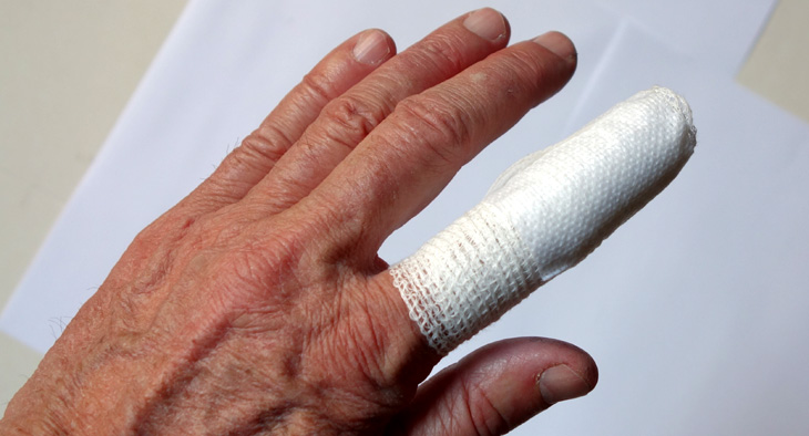 A photo of a finger with a bandage on it.
